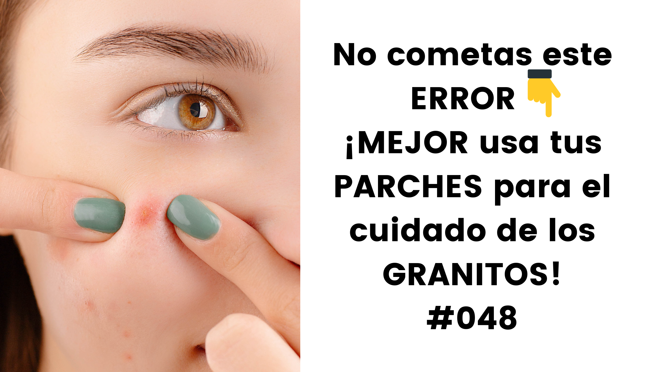 ¿Cómo darle el mejor uso a los parches para los GRANITOS? #48