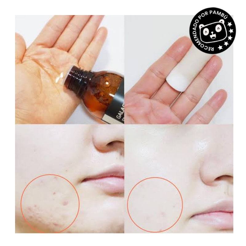 Tónico rico en Vitamina C y Galactomyces de SomebyMi [Galactomyces Pure Vitamin C Glow Toner 200 ml]